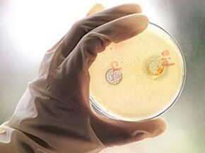 Вирусный гепатит