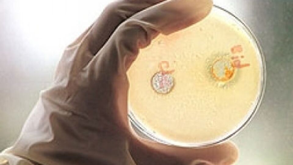 Вирусный гепатит