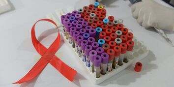 Символ борьбы со СПИДом в лаборатории
