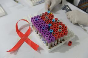 Символ борьбы со СПИДом в лаборатории
